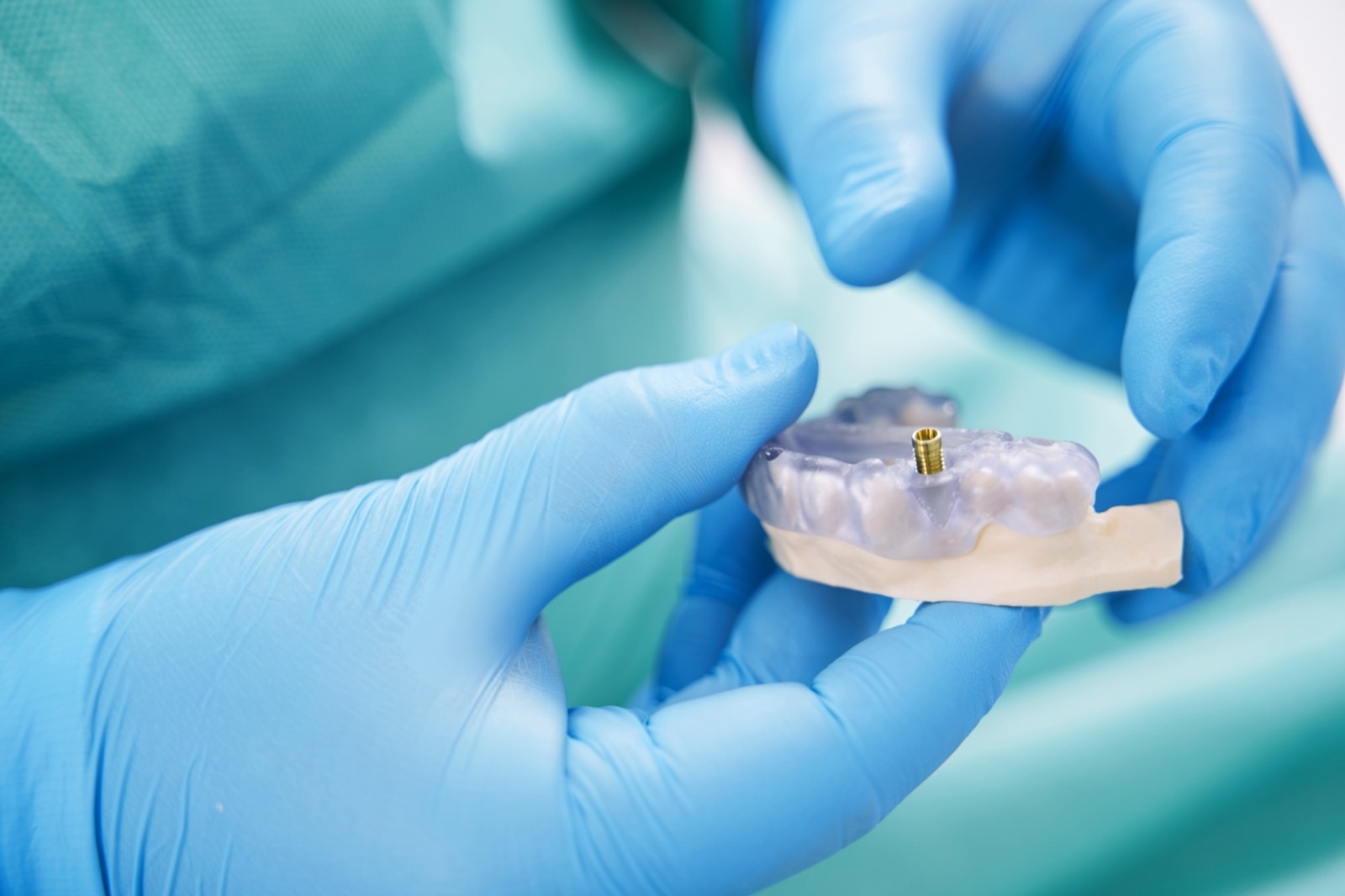 Close up of male stomatologist hands in sterile gloves holding false teeth with dental implant